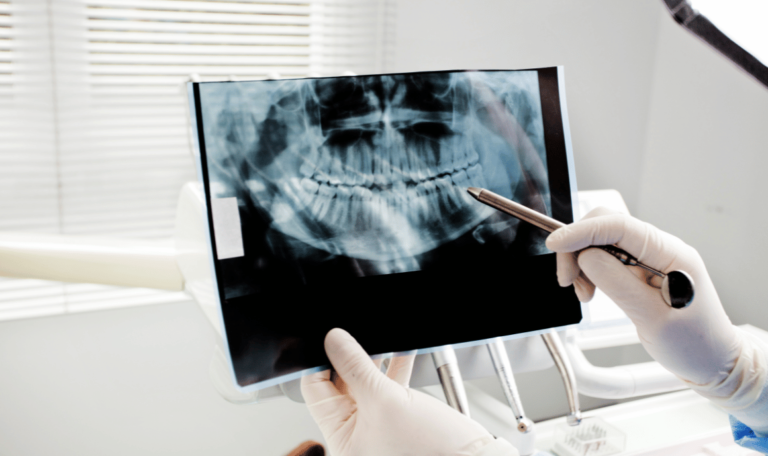 Dental X-rays at UK Dental Care Indore for accurate oral diagnosis
