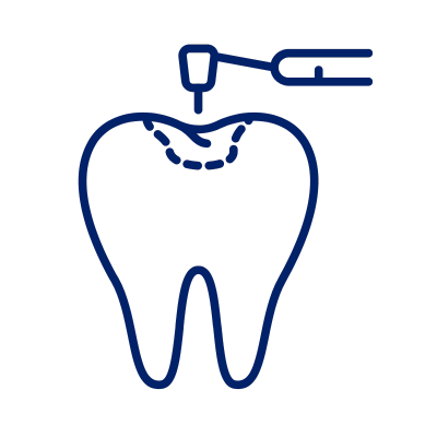 Dental Fillings