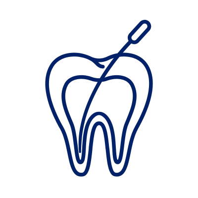 Root Canal Treatment