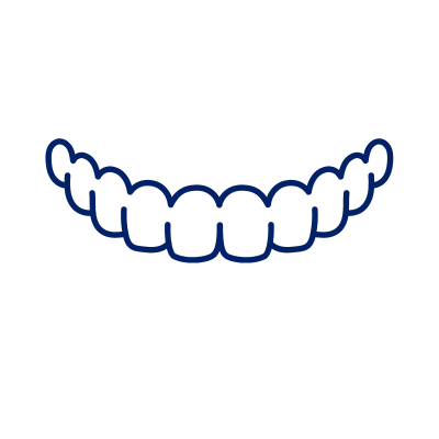 Clear Aligners