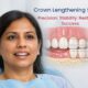 Patient in dental chair with diagram explaining crown lengthening surgery showing reshaped gum line and exposed tooth structure